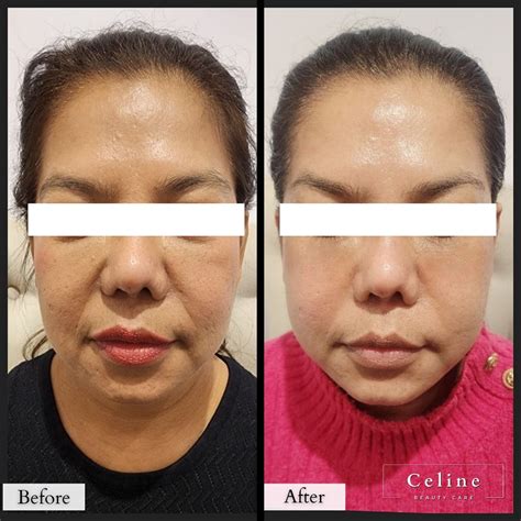 celine beauty care